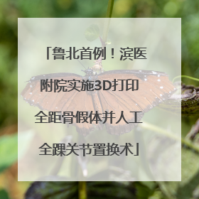鲁北首例！滨医附院实施3D打印全距骨假体并人工全踝关节置换术